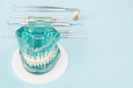 orthodontic model and dentist tool - demonstration teeth model of varities of orthodontic bracket or braceの写真素材