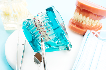 orthodontic model and dentist tool - demonstration teeth model of varities of orthodontic bracket or braceの写真素材