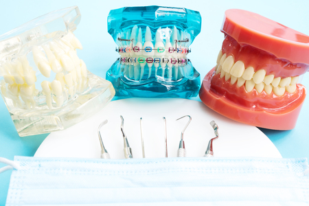orthodontic model and dentist tool - demonstration teeth model of varities of orthodontic bracket or braceの写真素材