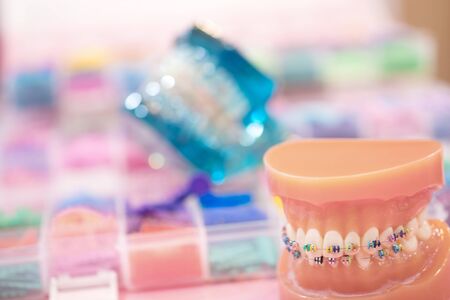 orthodontic model and dentist tool - demonstration teeth model of varities of orthodontic bracket or braceの写真素材