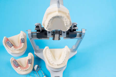 Crown and bridge equipment and model express fix restoration.の写真素材