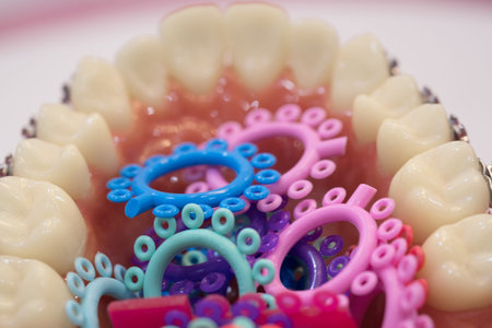 orthodontic model and dentist tool - demonstration teeth model of varities of orthodontic bracket or...