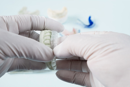 Dental  retainer orthodontic appliance on the blue background.の写真素材