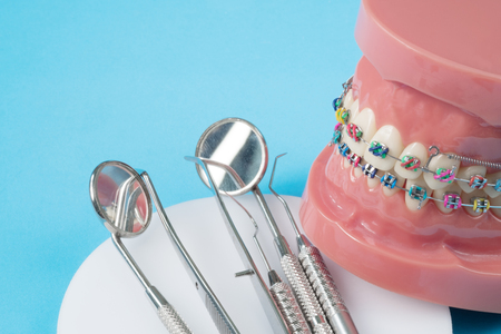 orthodontic model and dentist tool - demonstration teeth model of varities of orthodontic bracket or braceの写真素材