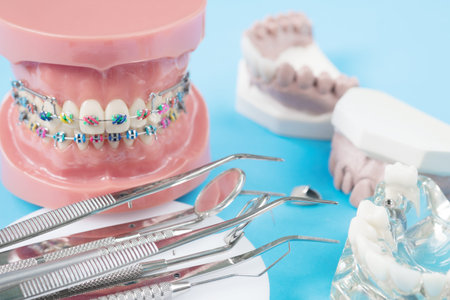 orthodontic model and dentist tool - demonstration teeth model of varities of orthodontic bracket or...