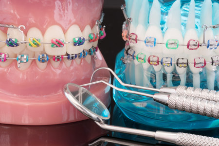 orthodontic model and dentist tool - demonstration teeth model of varities of orthodontic bracket or...