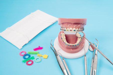 orthodontic model and dentist tool - demonstration teeth model of varities of orthodontic bracket or braceの写真素材