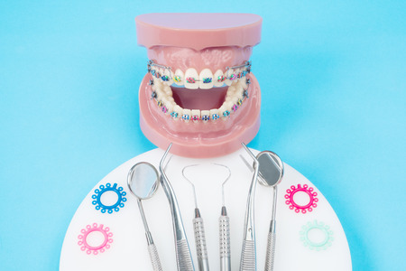 orthodontic model and dentist tool - demonstration teeth model of varities of orthodontic bracket or braceの写真素材