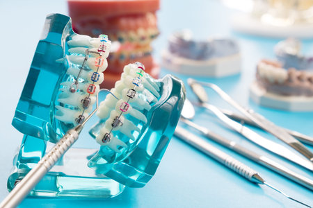 orthodontic model and dentist tool - demonstration teeth model of varities of orthodontic bracket or...