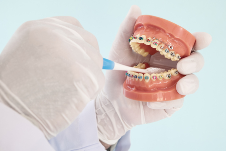 orthodontic model and dentist tool - demonstration teeth model of varities of orthodontic bracket or braceの写真素材
