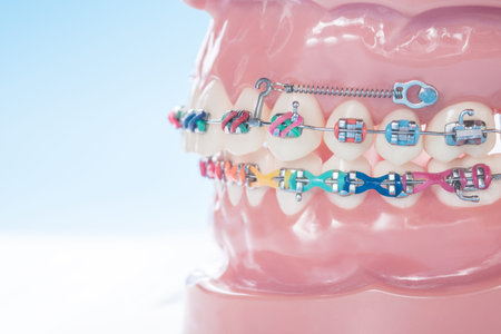 orthodontic model and dentist tool - demonstration teeth model of varities of orthodontic bracket or...