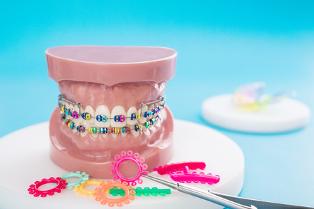 orthodontic model and dentist tool - demonstration teeth model of varities of orthodontic bracket or braceの写真素材
