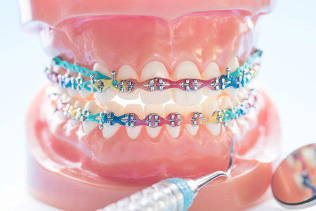 orthodontic model and dentist tool - demonstration teeth model of varities of orthodontic bracket or...