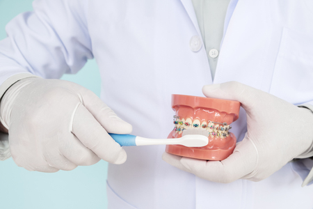 orthodontic model and dentist tool - demonstration teeth model of varities of orthodontic bracket or braceの写真素材