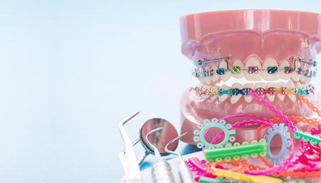 orthodontic model and dentist tool - demonstration teeth model of varities of orthodontic bracket or braceの写真素材