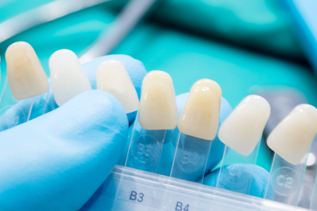 Close up shade guide for check color of tooth crown in clinic.の写真素材