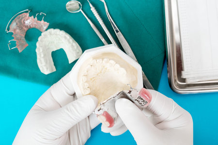 Removable partial denture (RPD.) on blue background.