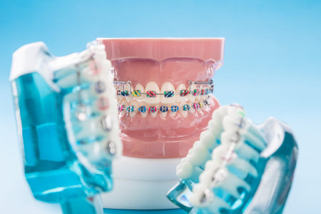 orthodontic model and dentist tool - demonstration teeth model of varities of orthodontic bracket or...