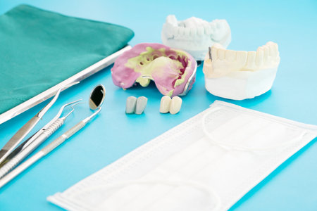 Implan model tooth support fix bridge implan and crown.