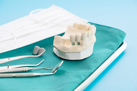 Implan model tooth support fix bridge implan and crown.