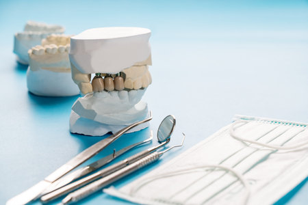 Close up Implant model tooth support fix bridge implant and crown.