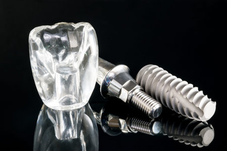 Close up dental implant  model on black background.