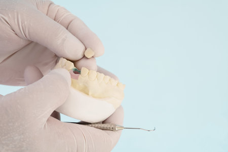 Prosthodontics or Prosthetic / Crown and bridge equipment and model express fix restoration.