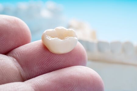 Closeup / Prosthodontics or Prosthetic / Single teeth crown and bridge equipment model express fix restoration.の写真素材