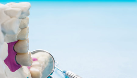 Closeup / Implant Prosthodontics or Prosthetic / Tooth crown and bridge implant dentistry equipment...