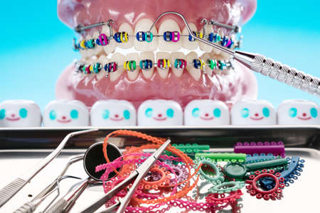 orthodontic model and dentist tool - demonstration teeth model of varities of orthodontic bracket or braceの写真素材
