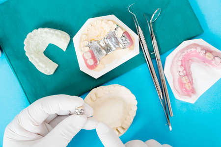 Implan model tooth support fix bridge implan and crown.の写真素材