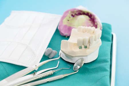 Implant model tooth support fix bridge implan and crown.の写真素材