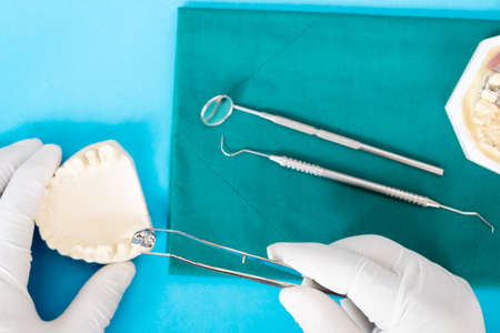 Closeup / Implant Prosthodontics or Prosthetic / Tooth crown and bridge implant dentistry equipment and model express fix restoration.の写真素材