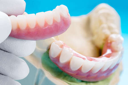 orthodontic model and dentist tool - demonstration teeth model of varities of orthodontic bracket or braceの写真素材