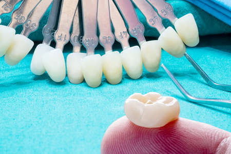 Dental implant work is completed and ready to use/ dental implant temporary abutmentの写真素材