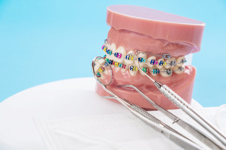 orthodontic model and dentist tool - demonstration teeth model of varities of orthodontic bracket or...