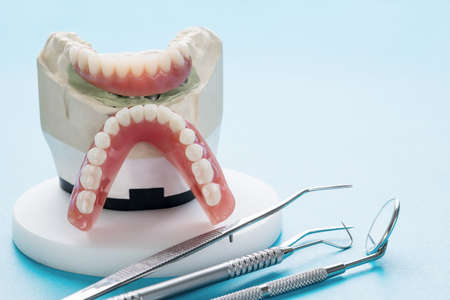orthodontic model and dentist tool - demonstration teeth model of varities of orthodontic bracket or braceの写真素材