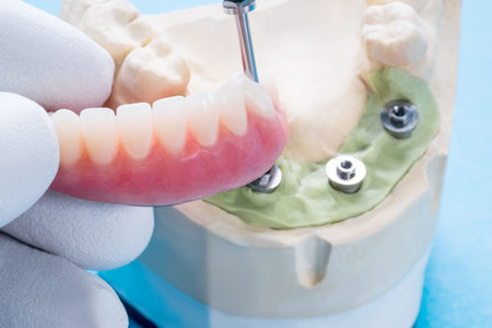 Dentistry medical tools forcept on blue background.