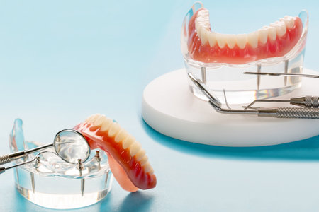 Closeup/ Dental implants supported overdenture on blue background/ Screw retained/ implant restorations.の写真素材
