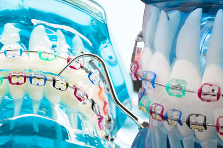 Dental tools use for dentist in the office or clinic.の写真素材