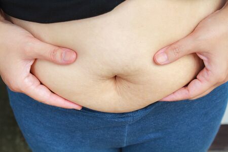 Asian girl paunchy fat overweight should lose weight.の写真素材