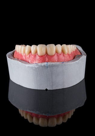 Complete maxillary denture upside down on plaster model - Wax-Up and Gingival Contouring in front...