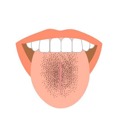 Illustration of tongue symptoms and healthの写真素材