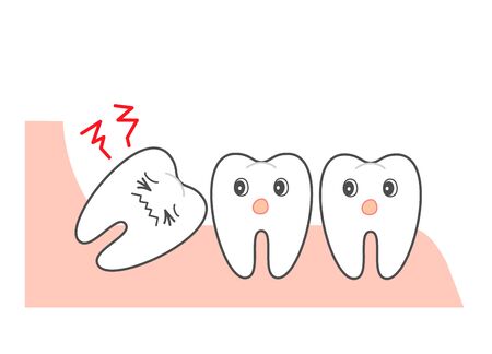  Wisdom tooth and alignmentãorthodonticのイラスト素材