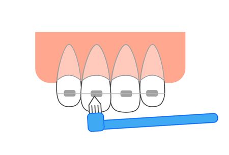 single-tuft toothbrush to remove leftover foodのイラスト素材