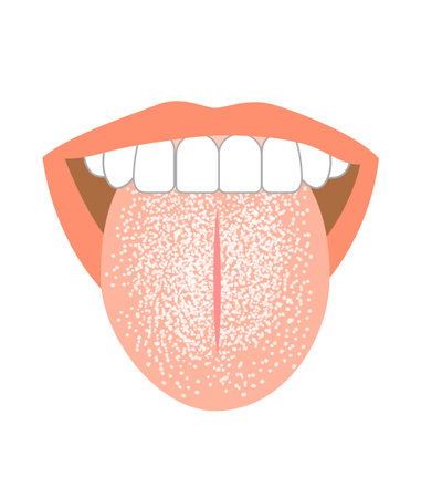 Healthy tongue trouble symptoms on tongueのイラスト素材