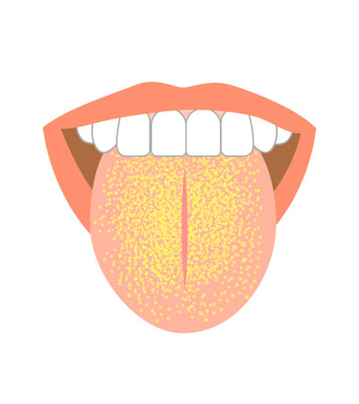 Healthy tongue trouble symptoms on tongueのイラスト素材