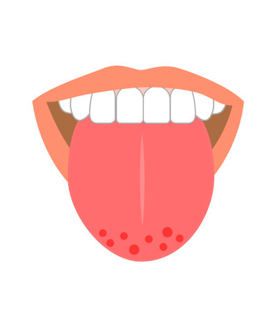 Healthy tongue trouble symptoms on tongueのイラスト素材