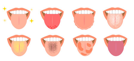 Healthy tongue trouble symptoms on tongueのイラスト素材