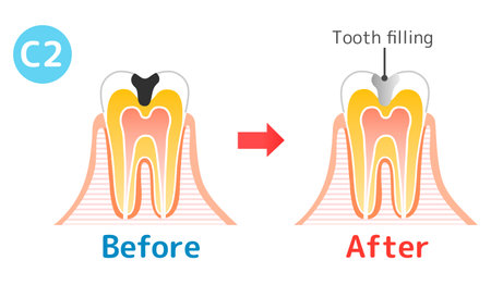 Tuft brush toothpaste leftover foodのイラスト素材